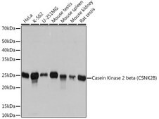 Anti-Casein Kinase 2 beta (CSNK2B) Antibody, clone 9T5J10, Rabbit Monoclonal