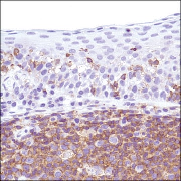 Anti-CSF-1R antibody, Rabbit monoclonal clone SP211, recombinant, expressed in proprietary host, affinity isolated antibody