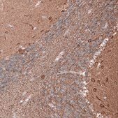 Monoclonal Anti-TUBB3 antibody produced in mouse Prestige Antibodies&#174; Powered by Atlas Antibodies, clone CL5814, purified immunoglobulin, buffered aqueous glycerol solution