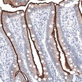 Monoclonal Anti-ACE2 antibody produced in mouse Prestige Antibodies&#174; Powered by Atlas Antibodies, clone CL4035, purified immunoglobulin