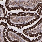Anti-MAOB antibody produced in rabbit Prestige Antibodies&#174; Powered by Atlas Antibodies, affinity isolated antibody, buffered aqueous glycerol solution