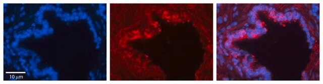 Anti-LDHA affinity isolated antibody