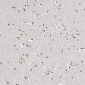 Anti-TRIM66 antibody produced in rabbit Prestige Antibodies&#174; Powered by Atlas Antibodies, affinity isolated antibody, buffered aqueous glycerol solution