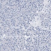 Anti-OPRM1 antibody produced in rabbit Prestige Antibodies&#174; Powered by Atlas Antibodies, affinity isolated antibody, buffered aqueous glycerol solution
