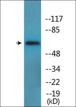 Anti-phospho-Moesin/Ezrin/Radixin (pThr558) antibody produced in rabbit affinity isolated antibody