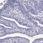 Anti-CPT1B antibody produced in rabbit Prestige Antibodies&#174; Powered by Atlas Antibodies, affinity isolated antibody, buffered aqueous glycerol solution