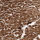 Anti-PTPRA antibody produced in rabbit Prestige Antibodies&#174; Powered by Atlas Antibodies, affinity isolated antibody, buffered aqueous glycerol solution