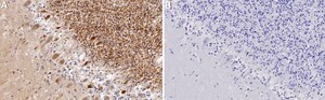 Anti-CaM Kinase II β Antibody, clone 1F13 ZooMAb&#174; Rabbit Monoclonal recombinant, expressed in HEK 293 cells