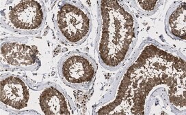 Anti-GAPDH Antibody, clone 10B13, ZooMAb&#174; Rabbit Monoclonal recombinant, expressed in HEK 293 cells