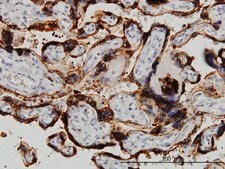 Monoclonal Anti-HSD3B1 antibody produced in mouse clone 3C11-D4, purified immunoglobulin, buffered aqueous solution