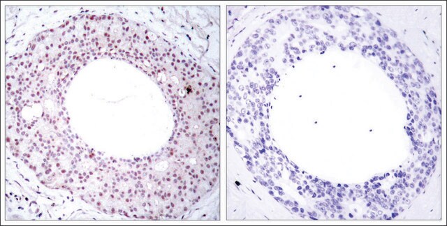 Anti-phospho-RELA (p65/pThr254) antibody produced in rabbit affinity isolated antibody