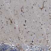Anti-P2RY12 antibody produced in rabbit Prestige Antibodies&#174; Powered by Atlas Antibodies, affinity isolated antibody, buffered aqueous glycerol solution