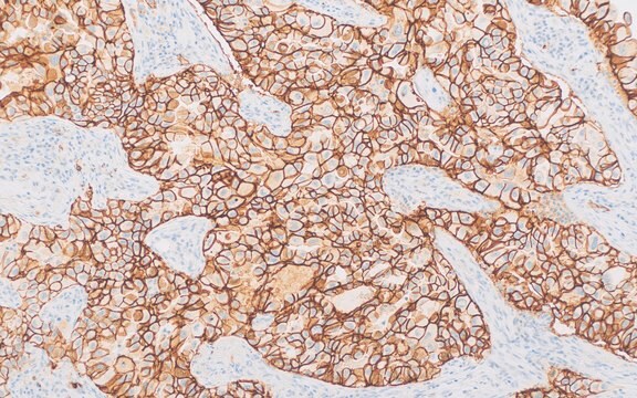 Claudin-4 (EP417) Rabbit Monoclonal Primary Antibody