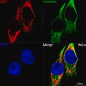 Anti-CaMKII Antibody, clone 7L9F0, Rabbit Monoclonal