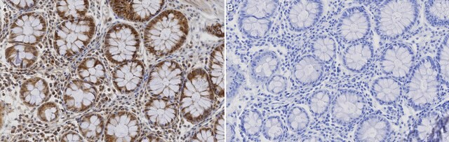 Anti-MICU1 Antibody, clone 1H13 ZooMAb&#174; Rabbit Monoclonal recombinant, expressed in HEK 293 cells