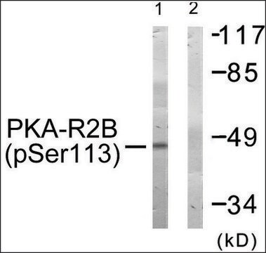 Anti-phospho-PKA-R2&#946; (pSer113) antibody produced in rabbit affinity isolated antibody