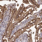 Anti-ADA antibody produced in rabbit Prestige Antibodies&#174; Powered by Atlas Antibodies, affinity isolated antibody, buffered aqueous glycerol solution
