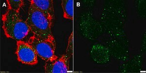 Anti-Collagen &#945;-4 Antibody, clone 1F3 ZooMAb&#174; Rabbit Monoclonal recombinant, expressed in HEK 293 cells