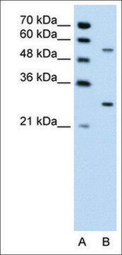 Anti-PDPK1 antibody produced in rabbit affinity isolated antibody