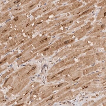 Anti-TARS2 antibody produced in rabbit Prestige Antibodies&#174; Powered by Atlas Antibodies, affinity isolated antibody, buffered aqueous glycerol solution