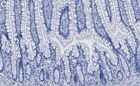 Anti-Calpain-1 Antibody, clone 1H14 ZooMAb&#174; Rabbit Monoclonal recombinant, expressed in HEK 293 cells