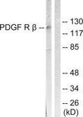 Anti-PDGFR &#946; antibody produced in rabbit affinity isolated antibody