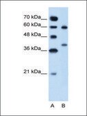 Anti-ARG1 IgG fraction of antiserum