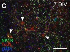 Anti-Substance P Receptor antibody produced in rabbit IgG fraction of antiserum, buffered aqueous solution