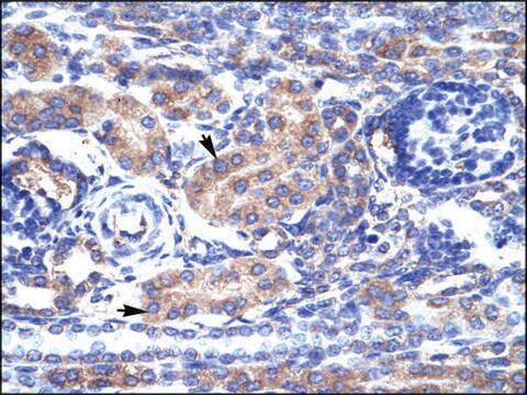 Anti-KCNAB3 antibody produced in rabbit IgG fraction of antiserum