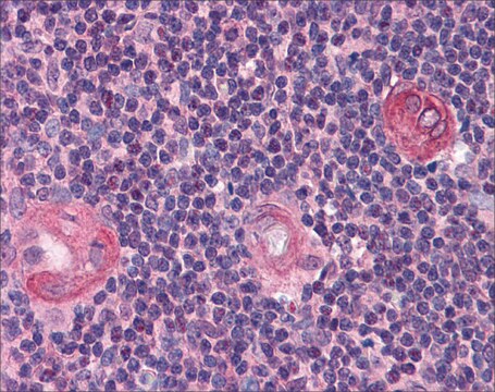 Anti-BCL11B antibody produced in rabbit affinity isolated antibody