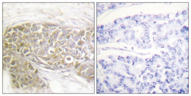 Anti-PEA-15 antibody produced in rabbit affinity isolated antibody