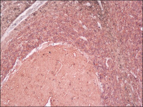 Anti-Neuron-Specific Enolase (NSE) antibody, Mouse monoclonal clone NSE-P2, purified from hybridoma cell culture