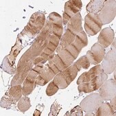Anti-CACNA1S antibody produced in rabbit Prestige Antibodies&#174; Powered by Atlas Antibodies, affinity isolated antibody, buffered aqueous glycerol solution