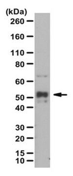 Anti-phospho NFkB p52, (Ser222) Antibody from rabbit, purified by affinity chromatography