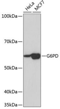 Anti-G6PD antibody produced in rabbit