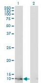 Monoclonal Anti-FABP4 antibody produced in mouse clone 2F12-1B11, ascites fluid, solution
