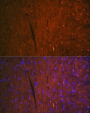 Anti-FABP3 Antibody, clone 9B9D7, Rabbit Monoclonal