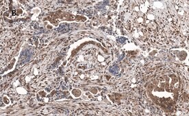 Anti-phospho JNK (Thr183, Tyr185) Antibody, clone 3F7, ZooMAb&#174; Rabbit Monoclonal recombinant, expressed in HEK 293 cells