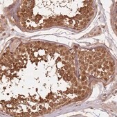 Anti-UBE3A antibody produced in rabbit Prestige Antibodies&#174; Powered by Atlas Antibodies, affinity isolated antibody, buffered aqueous glycerol solution