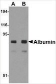 Anti-Albumin antibody produced in chicken affinity isolated antibody, buffered aqueous solution