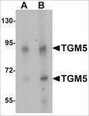Anti-TGM5 antibody produced in rabbit affinity isolated antibody