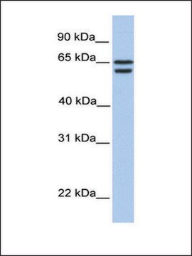 Anti-CDYL2 antibody produced in rabbit affinity isolated antibody