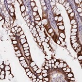 Anti-CYP2D6 antibody produced in rabbit Prestige Antibodies&#174; Powered by Atlas Antibodies, affinity isolated antibody, buffered aqueous glycerol solution