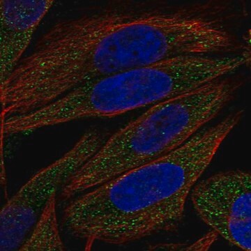 Anti-Ulbp2 Antibody Produced In Rabbit Prestige Antibodies&#174; Powered by Atlas Antibodies, affinity isolated antibody, buffered aqueous glycerol solution