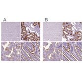 Anti-MME antibody produced in rabbit Prestige Antibodies&#174; Powered by Atlas Antibodies, affinity isolated antibody, buffered aqueous glycerol solution