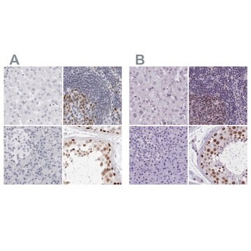 Anti-NASP antibody produced in rabbit Prestige Antibodies&#174; Powered by Atlas Antibodies, affinity isolated antibody, buffered aqueous glycerol solution