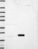 Anti-Kras Antibody Produced In Rabbit Prestige Antibodies&#174; Powered by Atlas Antibodies, affinity isolated antibody, buffered aqueous glycerol solution