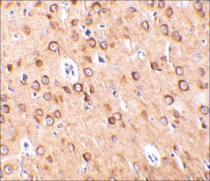 Anti-CTRP4 (ab1) antibody produced in rabbit affinity isolated antibody, buffered aqueous solution