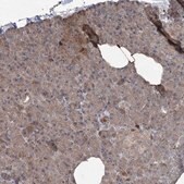 Anti-MAPK8IP2 antibody produced in rabbit Prestige Antibodies&#174; Powered by Atlas Antibodies, affinity isolated antibody, buffered aqueous glycerol solution