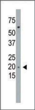 Anti-PMVK (C-term L177) antibody produced in rabbit IgG fraction of antiserum, buffered aqueous solution